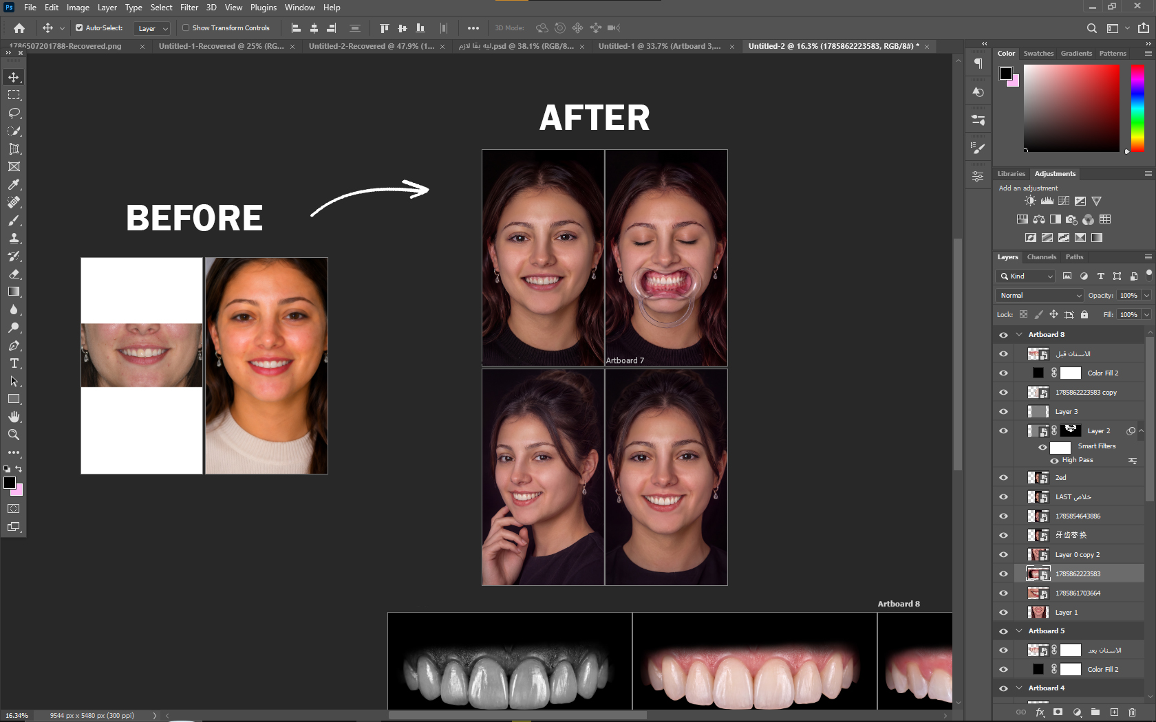 مثال Case Editing