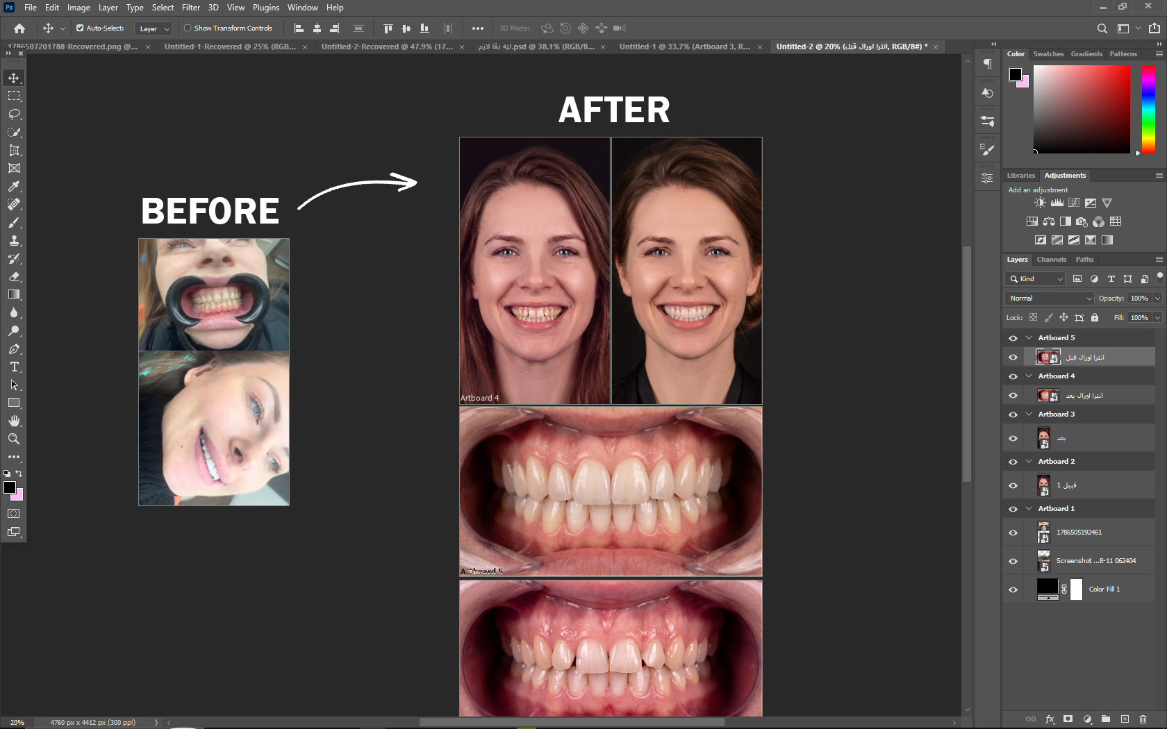 مثال Case Editing