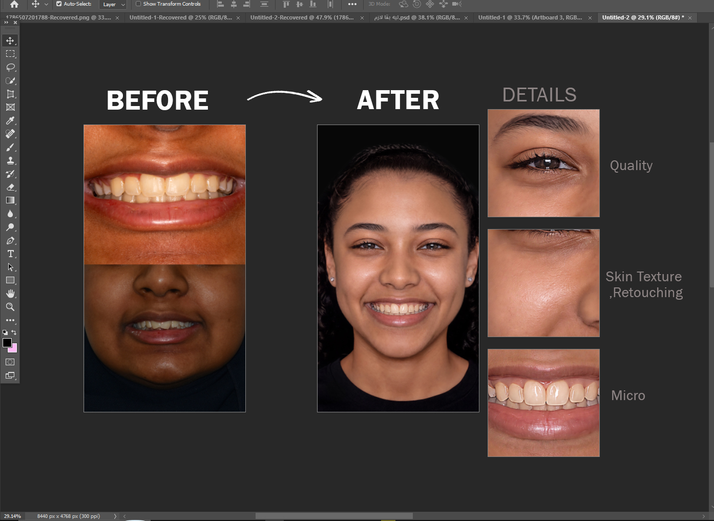 مثال Case Editing