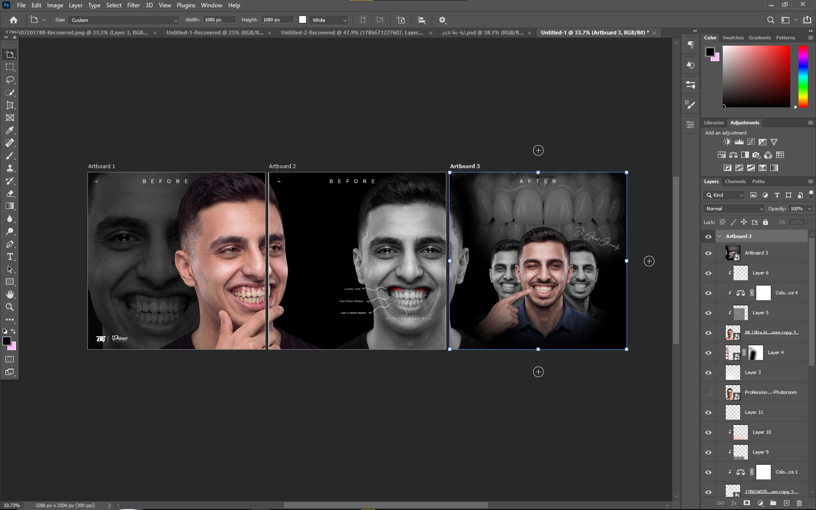مثال Case post Design