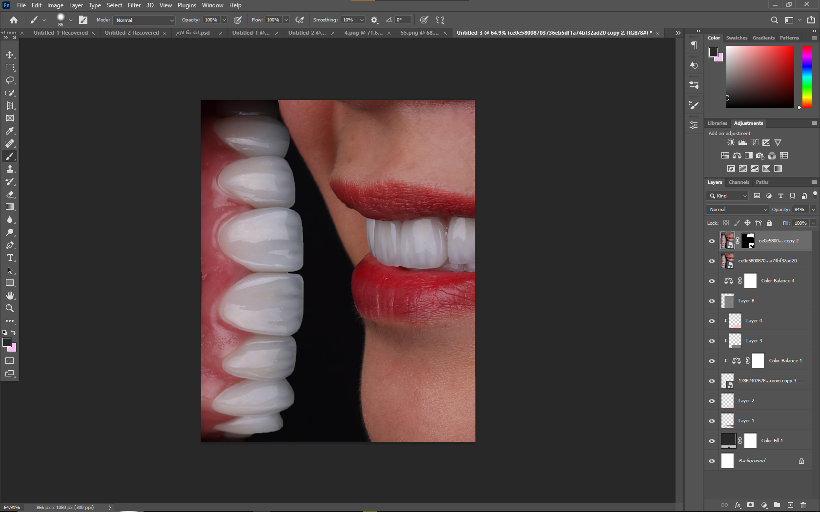 مثال Case post Design