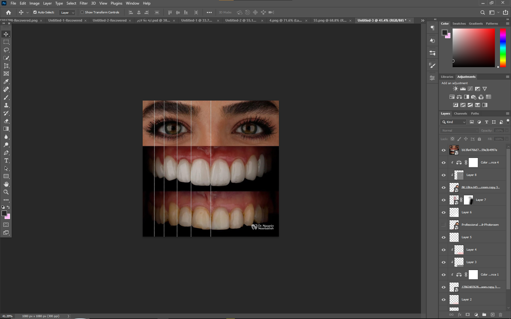 مثال Case post Design