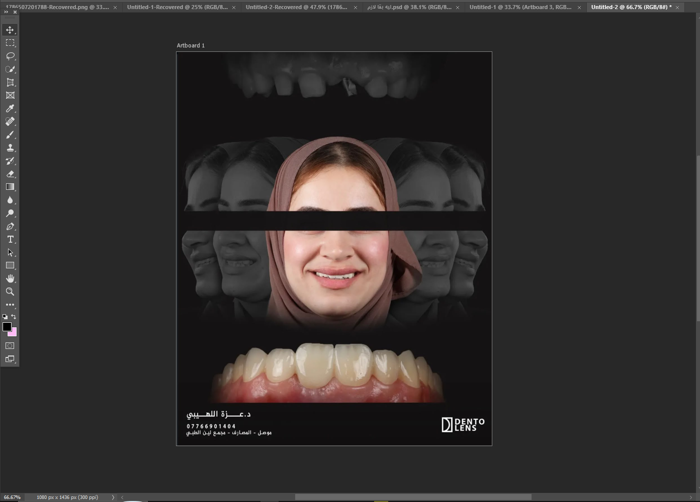 مثال Case post Design