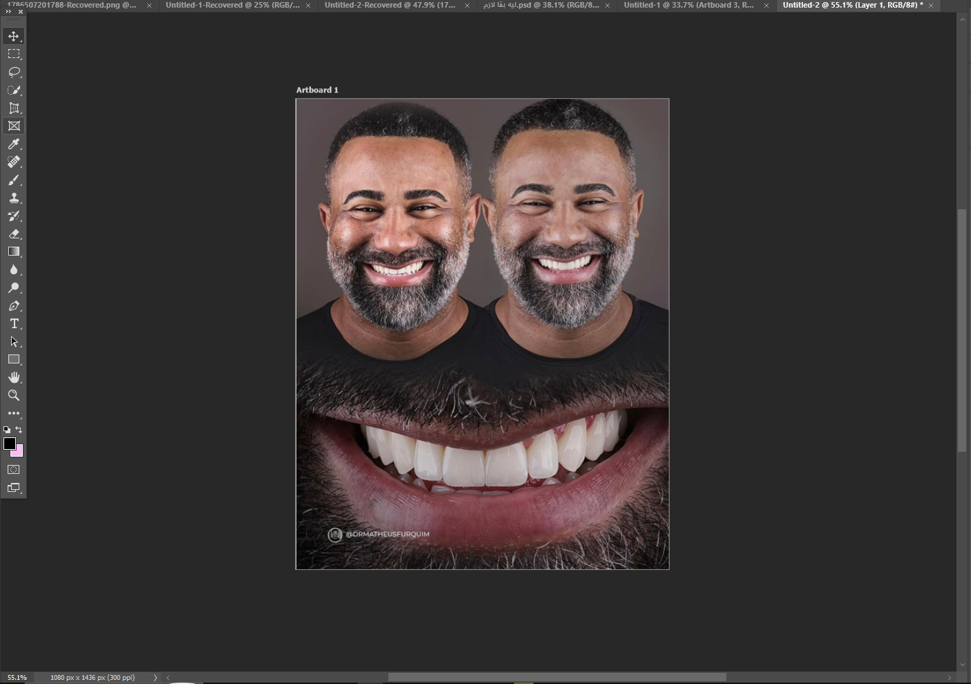 مثال Case post Design