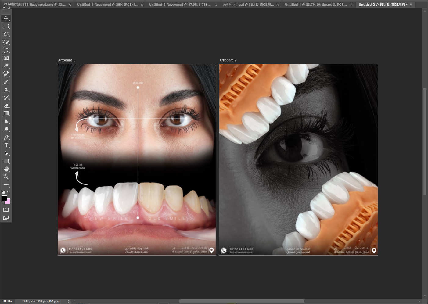 مثال Case post Design